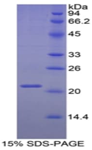 Mouse ITIH5 Protein (Recombinant His)