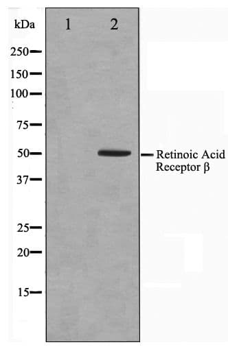 Polyclonal Rabbit anti-Human RARB / RAR Beta Antibody (IHC, WB)