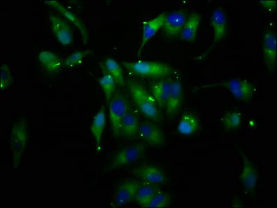 CD118 / LIF Receptor Alpha Antibody