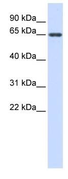 AMH / Anti-Mullerian Hormone Antibody (aa468-517)