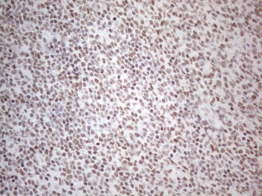 NR2C2 / TAK1 Antibody (aa1-241, clone OTI2H2)