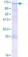 Human SEMA6C / Semaphorin 6C Protein (Recombinant GST)
