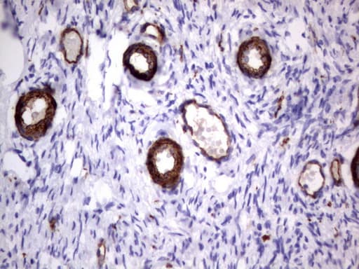 MCAM / CD146 Antibody (clone UMAB155)