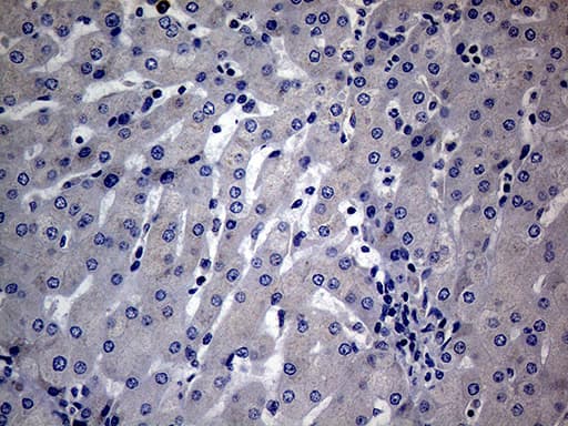 Monoclonal Mouse anti-Human DIRAS2 Antibody (clone OTI8A5, Carrier-free, aa1-196, IHC, WB)