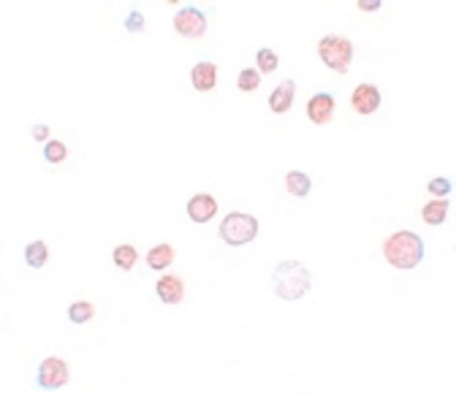 IHC-plus™ FREM1 Antibody