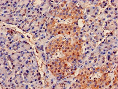 PSMB2 Antibody