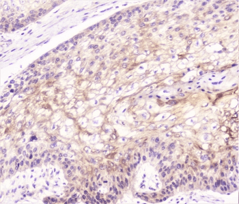 COMP / THBS5 Antibody