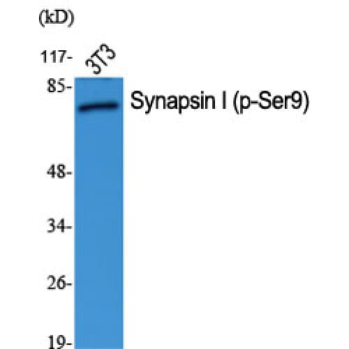 Polyclonal Rabbit anti-Human SYN1 / Synapsin 1 Antibody (1-80 aa, IHC, IF, WB)