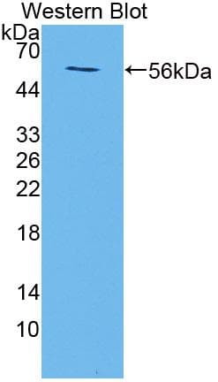 TMEM27 / Collectrin Antibody (aa12-222, APC)