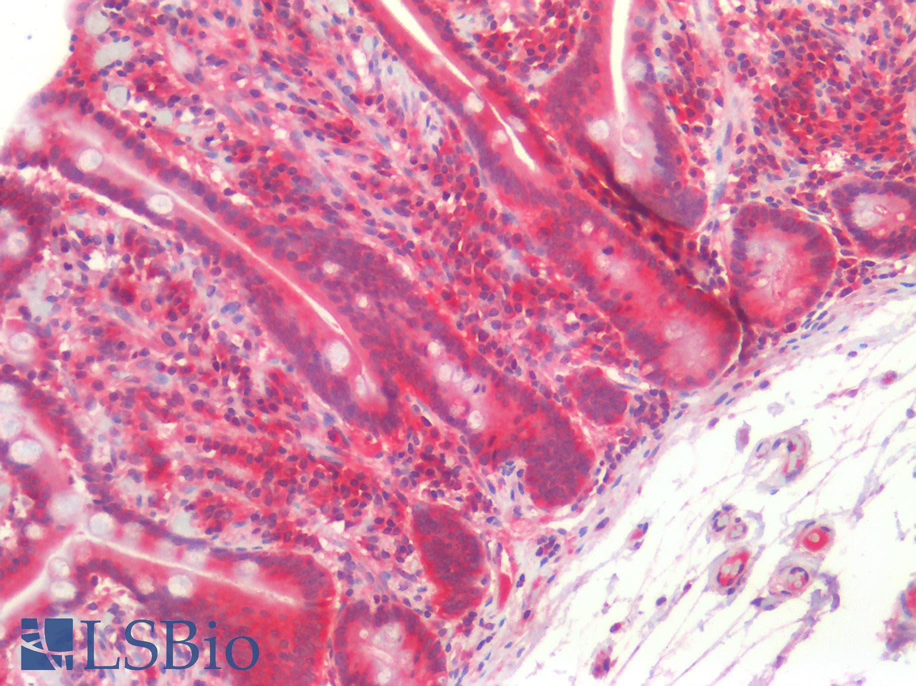 PathPlus™ Monoclonal Mouse anti-Human CD71 / Transferrin Receptor Antibody (clone H68.4, aa3-28, IHC, IF, WB)