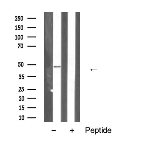 Polyclonal Rabbit anti-Human TNFRSF1B / TNFR2 Antibody (IF, WB)
