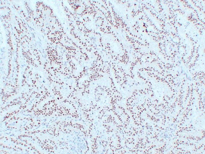 Monoclonal Mouse anti-Human MLH1 Antibody (clone ABT-MLH1, IHC, WB)