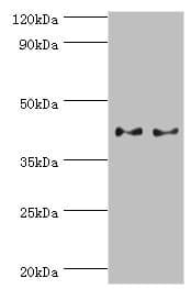 SERPINB5 / Maspin Antibody (aa21-189)