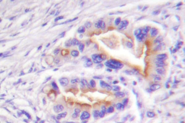 PRKCQ / PKC-Theta Antibody (Gly532)