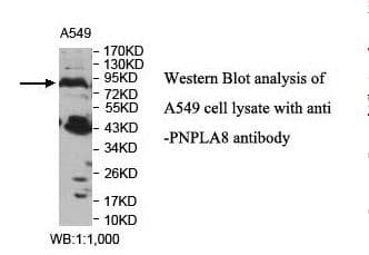 PNPLA8 Antibody (aa129-358)