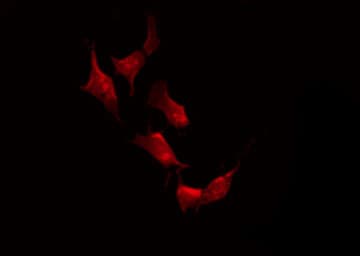 Polyclonal Rabbit anti-Human AKT2 Antibody (phospho-Ser474, IHC, IF, WB)