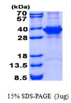 Human FN3KL / FN3KRP Protein (Recombinant His)