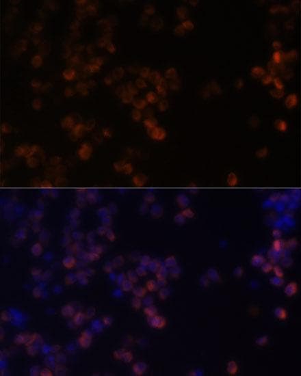 Polyclonal Rabbit anti-Human Zyxin Antibody (IHC, IF, WB)