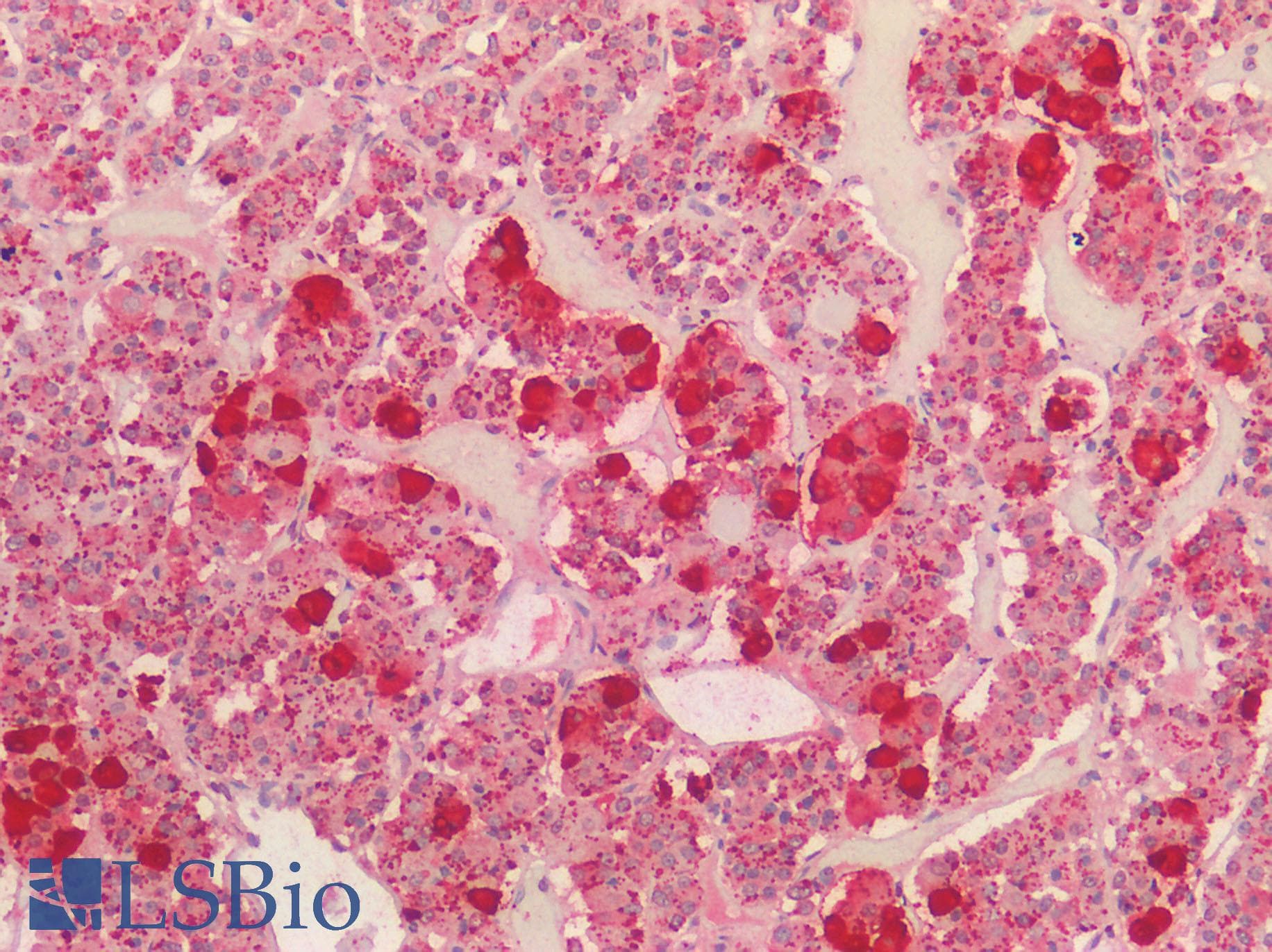IHC-plus™ POMC / Proopiomelanocortin Antibody