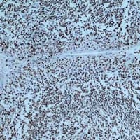 Monoclonal Mouse anti-Human PARP1 Antibody (IHC, WB)