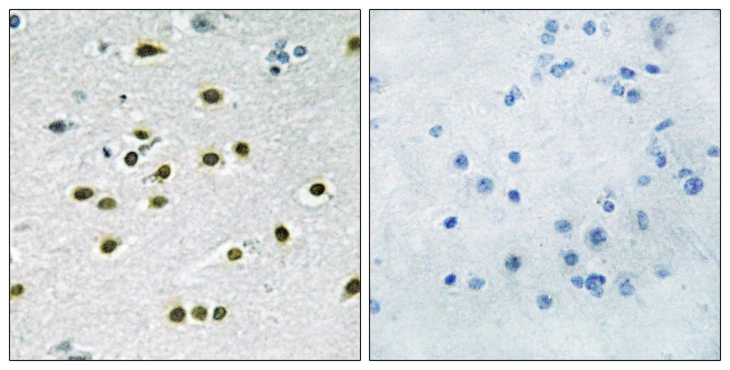 Polyclonal Rabbit anti-Human KLF10 + KLF11 Antibody (aa391-440, IHC)