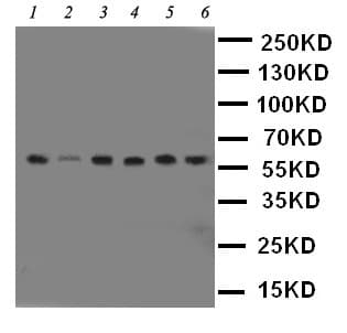 PAK1 Antibody (aa1-14)