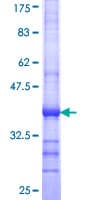 Human SKIV2L / SKI2 Protein (Recombinant GST, N-terminus)