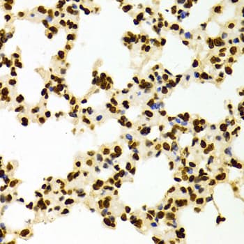 Histone H3 Antibody (Dimethyl-Lys27)