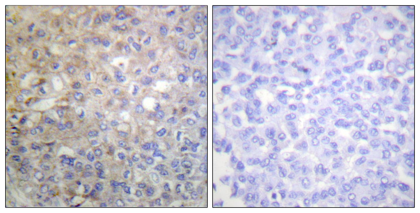 FGFR1 / FGF Receptor 1 Antibody (aa736-785)