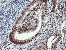 UBE2E3 Antibody (clone OTI6D3)