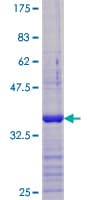 Human VDAC1 / PORIN Protein (Recombinant GST, N-terminus)