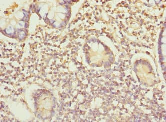 IP6K2 Antibody