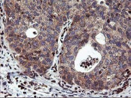 MEF2C Antibody (clone OTI1B6)