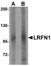 Polyclonal Rabbit anti-Human LRFN1 Antibody (IHC, IF, WB)