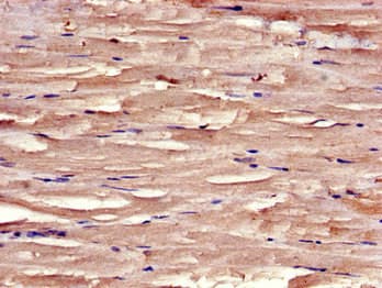 Polyclonal Rabbit anti-Human DMN / Desmuslin / Synemin Antibody (aa1147-1417, IHC, IF)