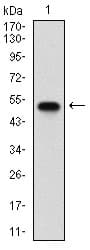 SDC1 / Syndecan 1 / CD138 Antibody (aa28-171, clone 1A3H4)