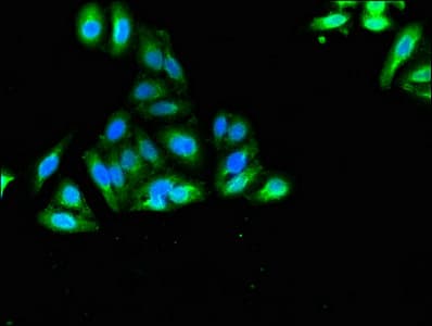 Polyclonal Rabbit anti-Human SORCS2 Antibody (aa712-786, IHC, IF)