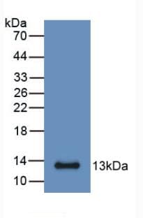 S100A6 / Calcyclin Antibody (FITC)