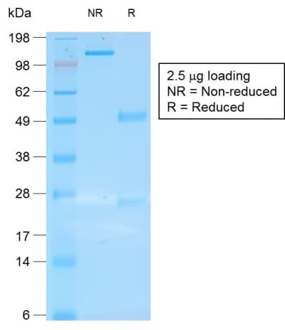 KRT19 / CK19 / Cytokeratin 19 Antibody (clone rKRT19/800, Azide-free, Carrier-free)