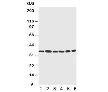 CDK4 Antibody (aa283-303)