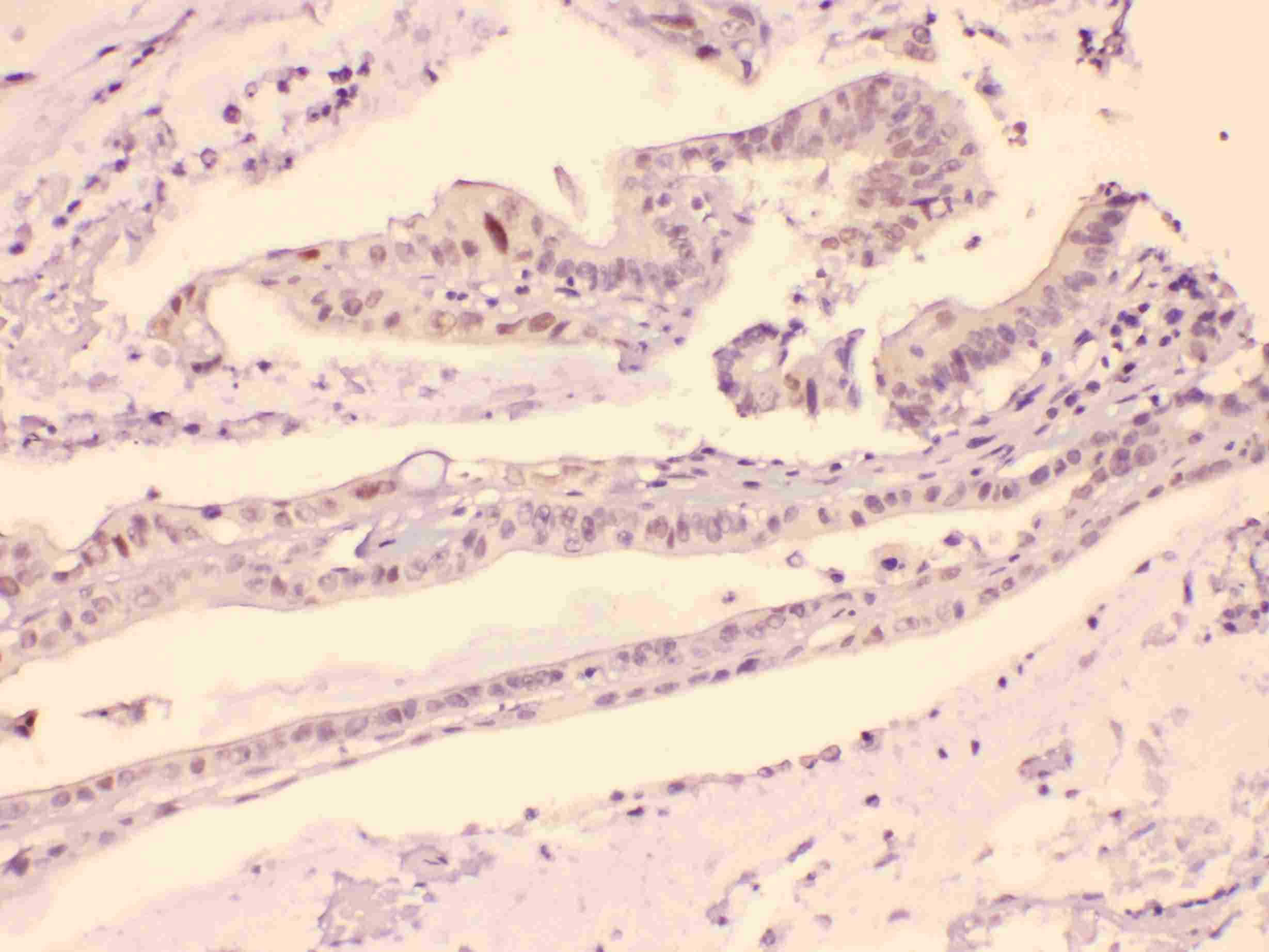 HDGF Antibody