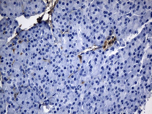 GTPCH1 / GCH1 Antibody (clone OTI2E2)