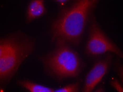 MARCKS Antibody (phospho-Ser158)