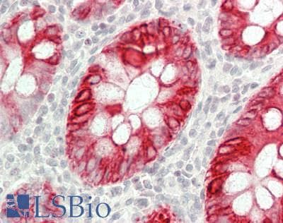 IHC-plus™ KRT20 / CK20 / Cytokeratin 20 Antibody (C-Terminus)