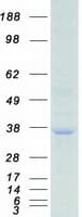 Human RPA2 / RFA2 / RPA34 Protein (Recombinant Myc-DDK (Flag))