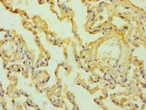 MSLN / Mesothelin Antibody (aa37-296)