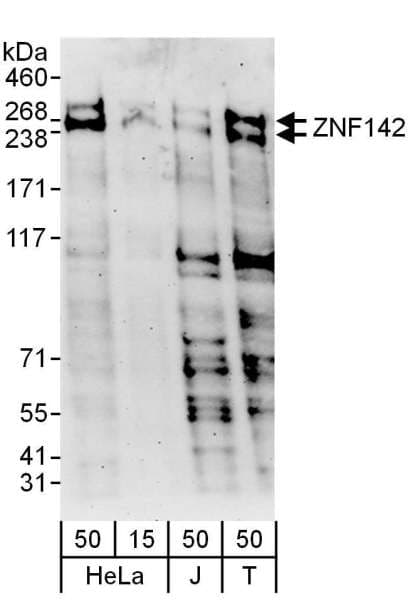 ZNF142 Antibody (aa1-50)