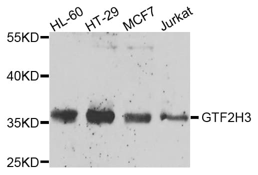 Polyclonal Rabbit anti-Human GTF2H3 Antibody (IHC, IF, WB)