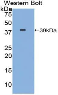 CPB / Carboxypeptidase B Antibody (aa111-417, Biotin)