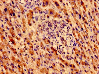 MTRF1 Antibody
